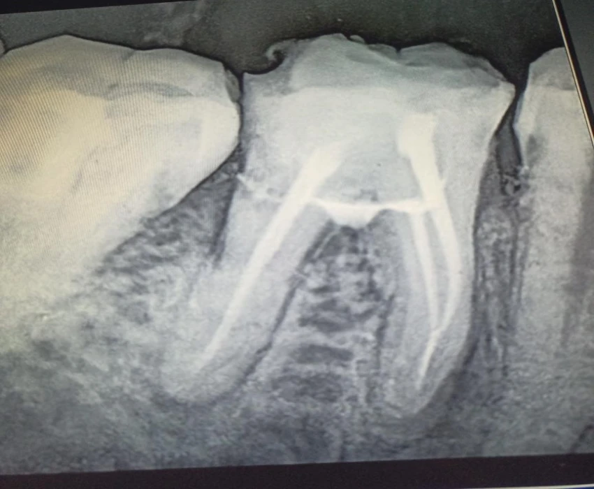 saraswati dental college