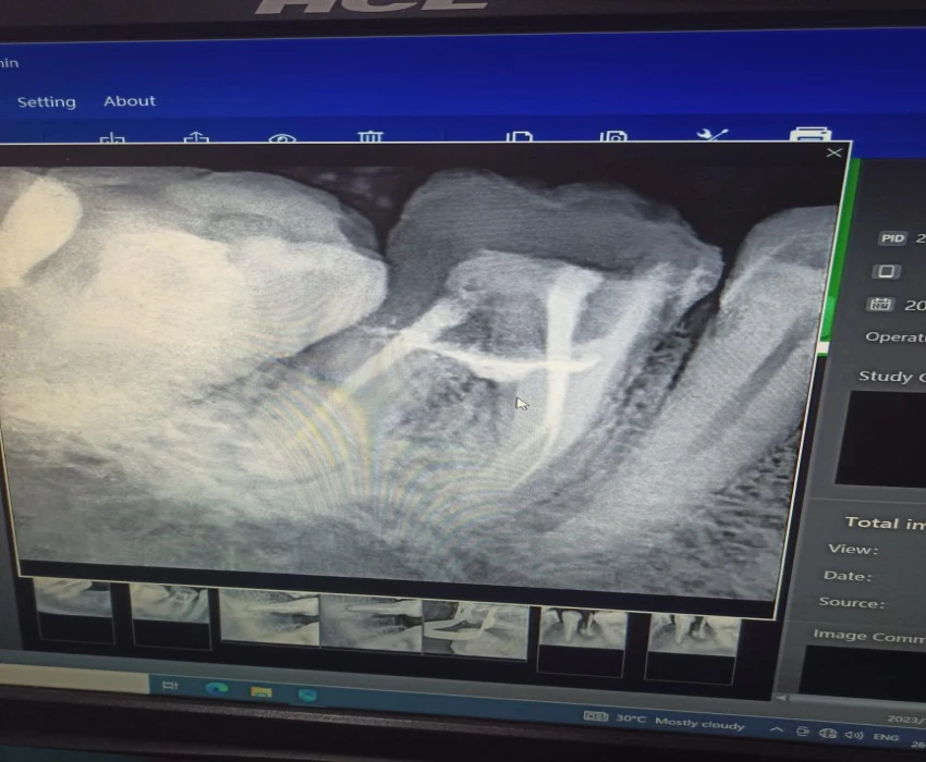 saraswati dental college