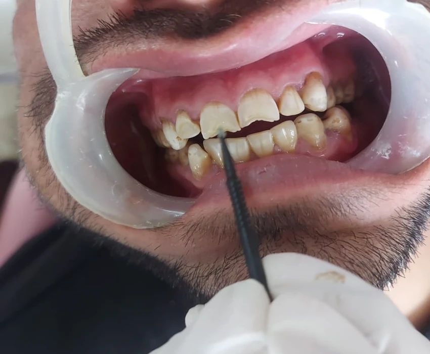 saraswati dental college