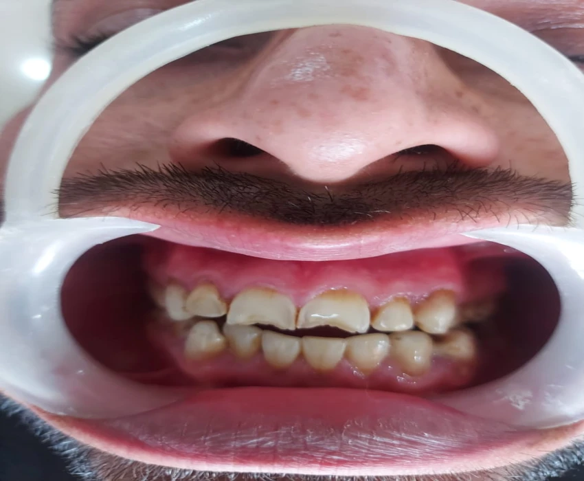 saraswati dental college