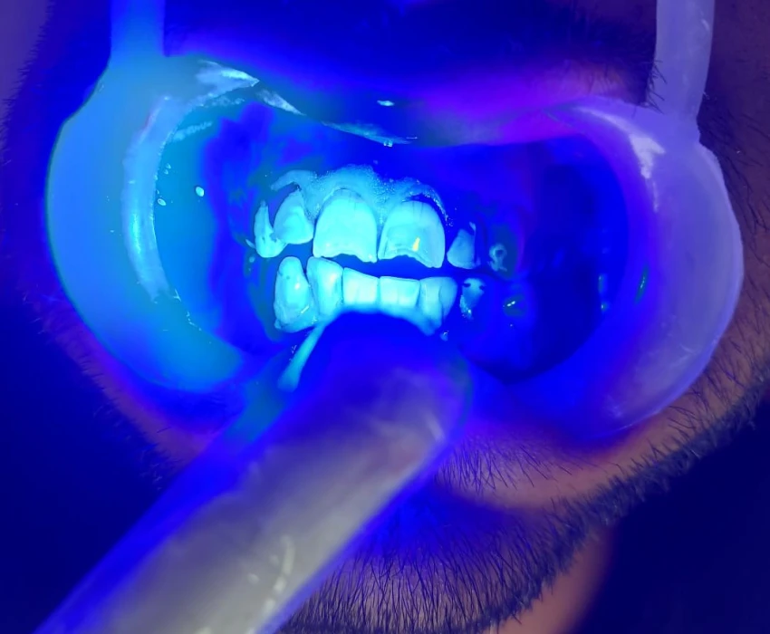 saraswati dental college