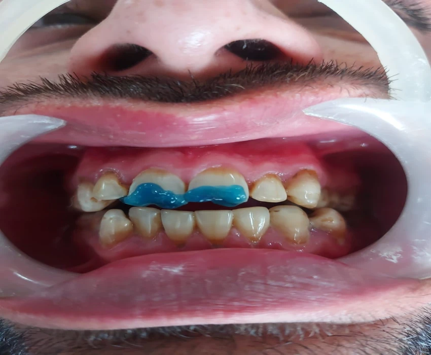 saraswati dental college