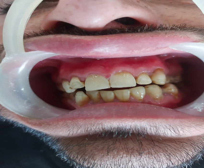 saraswati dental college