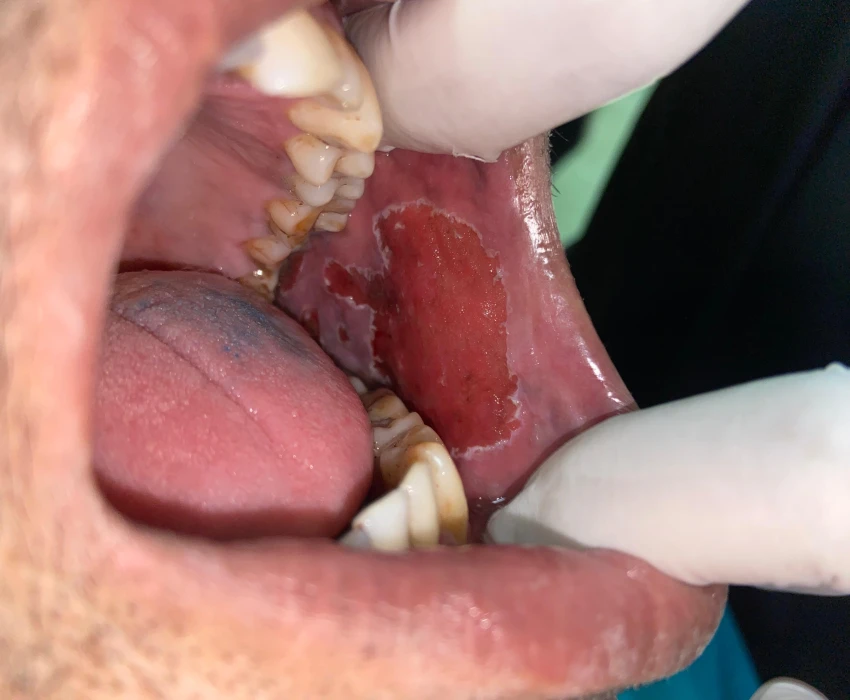 saraswati dental college