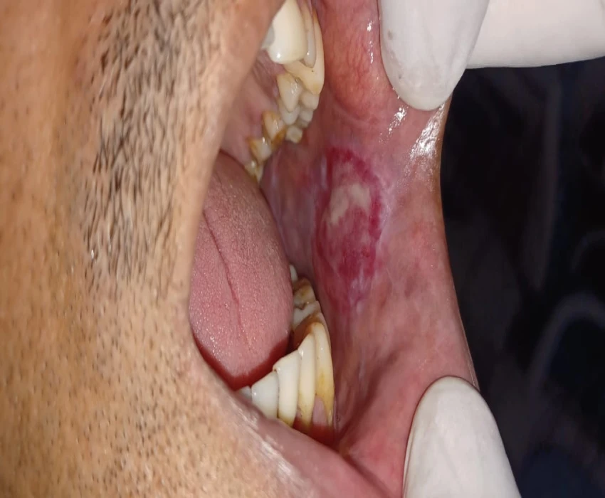 saraswati dental college