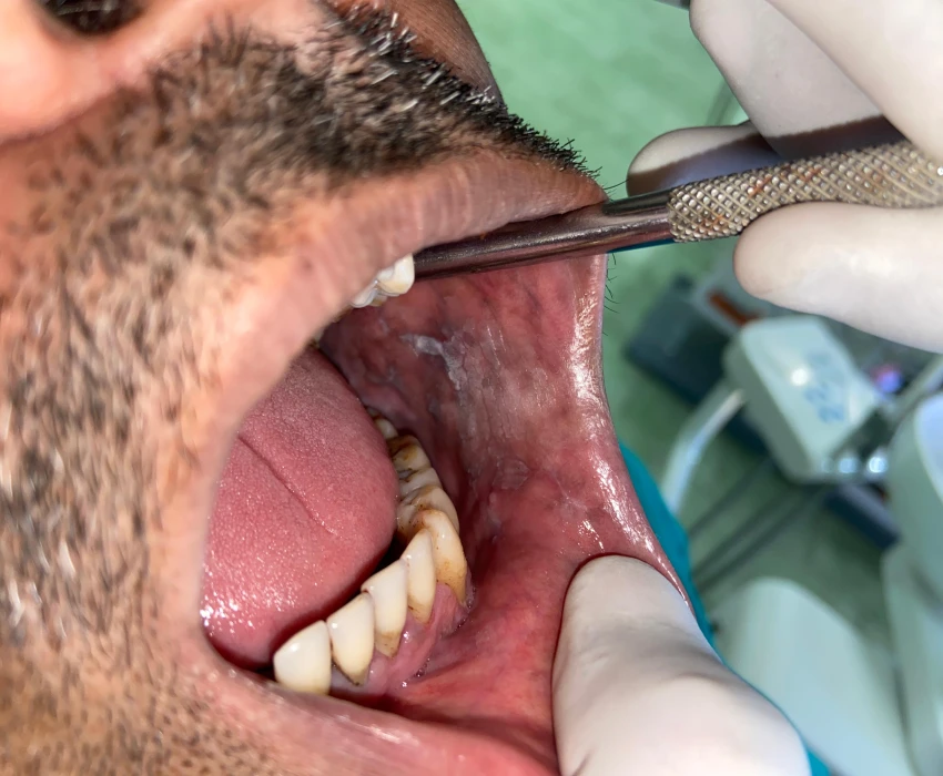 saraswati dental college