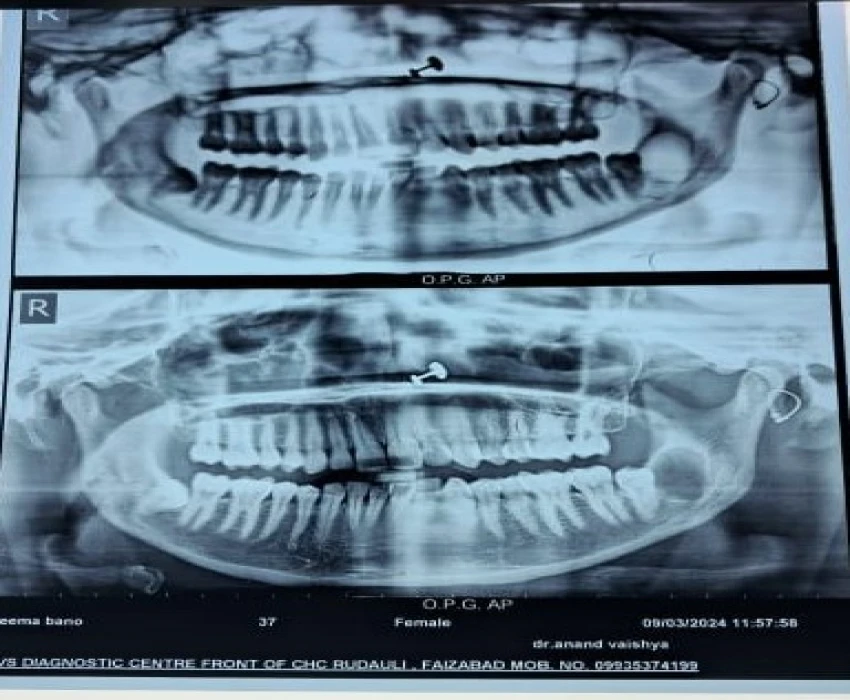 saraswati dental college