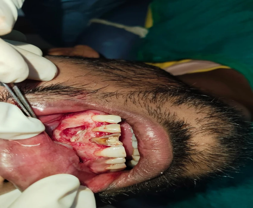 saraswati dental college