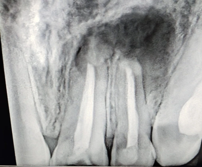 saraswati dental college