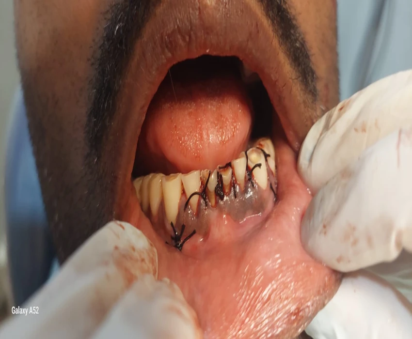 saraswati dental college