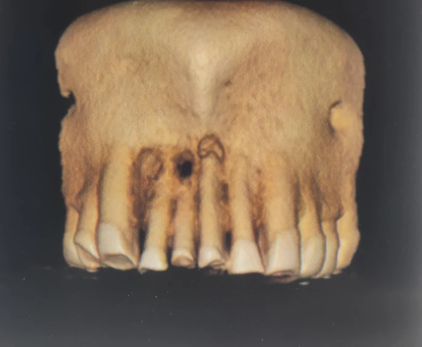 saraswati dental college