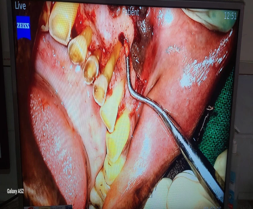 saraswati dental college