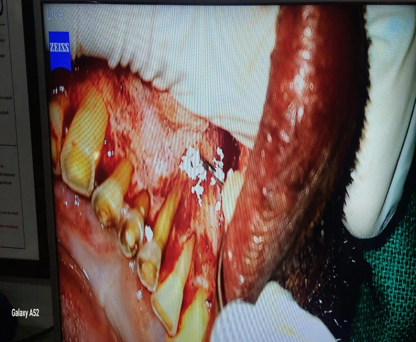 saraswati dental college