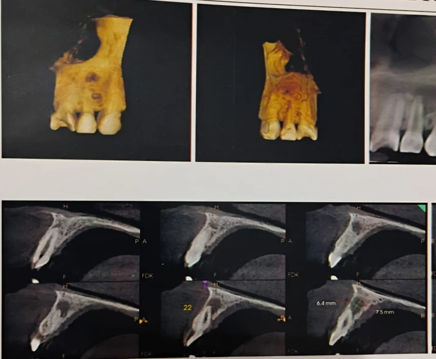 saraswati dental college