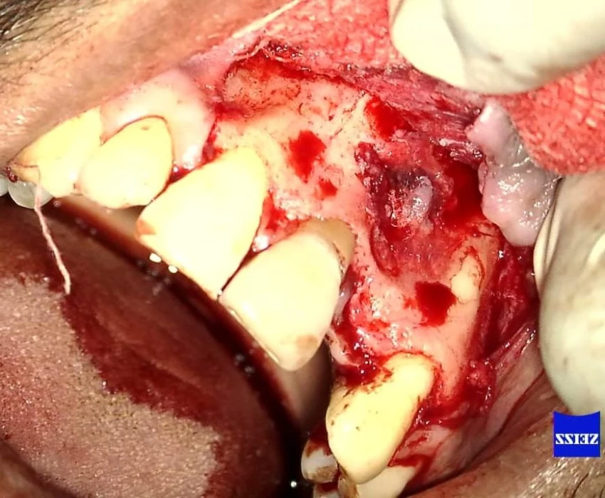 saraswati dental college