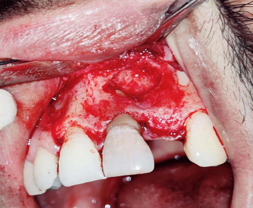 saraswati dental college