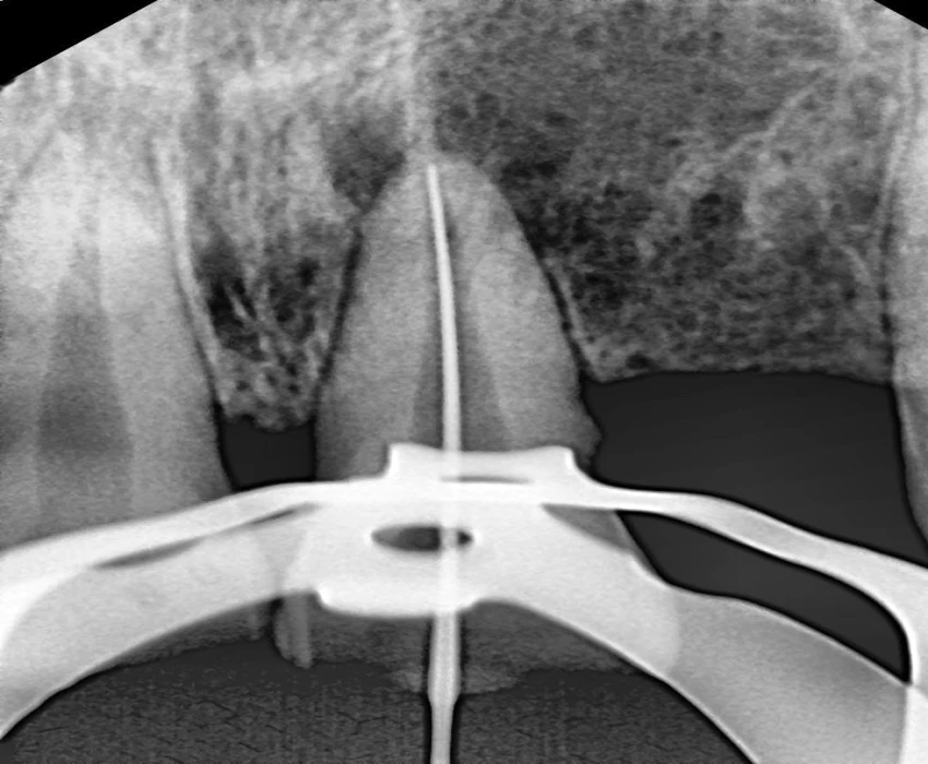 saraswati dental college