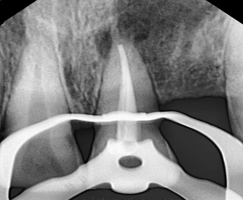 saraswati dental college