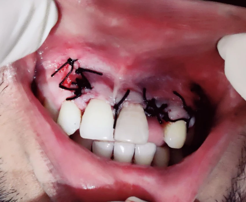 saraswati dental college