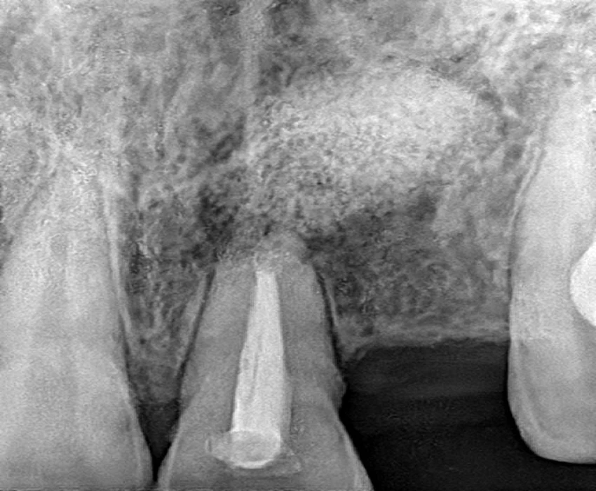 saraswati dental college