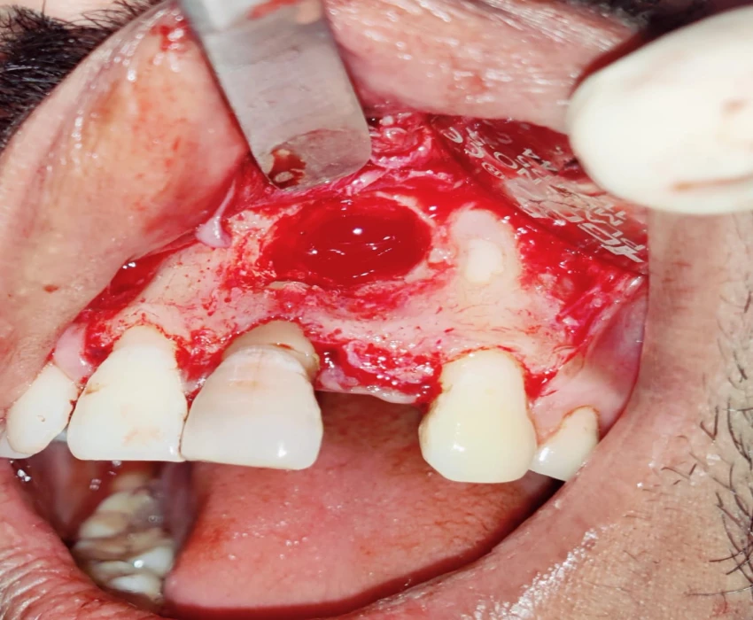 saraswati dental college