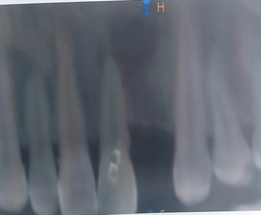 saraswati dental college