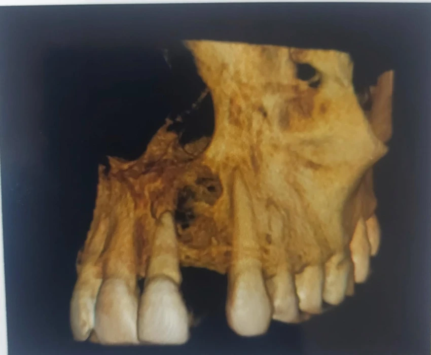 saraswati dental college