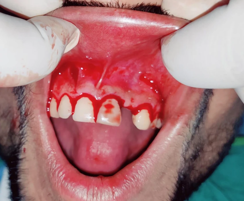 saraswati dental college