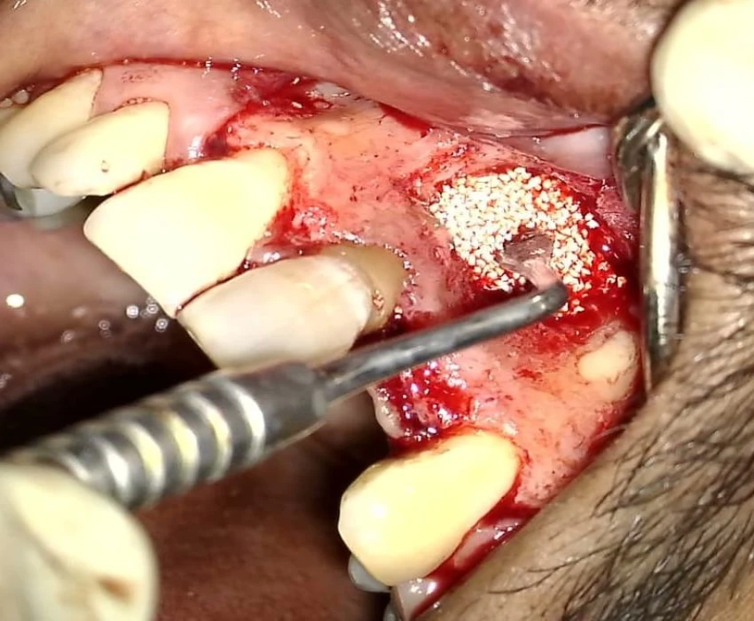 saraswati dental college