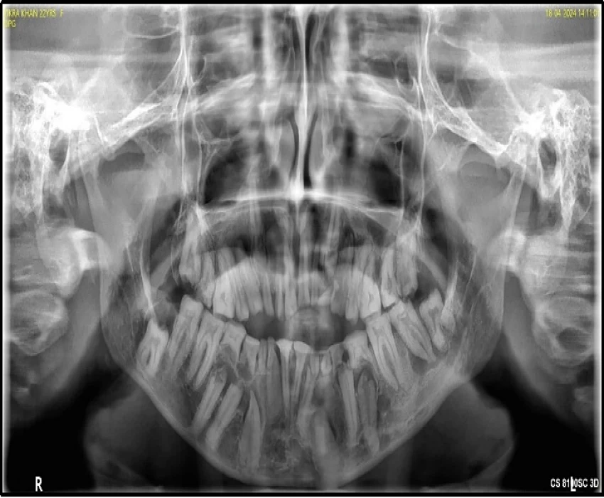 saraswati dental college