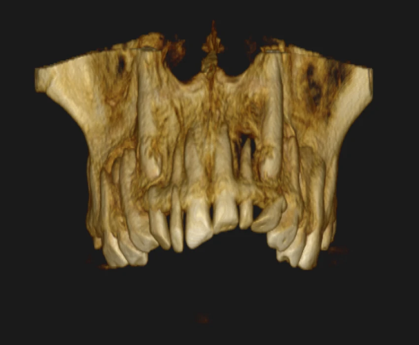 saraswati dental college