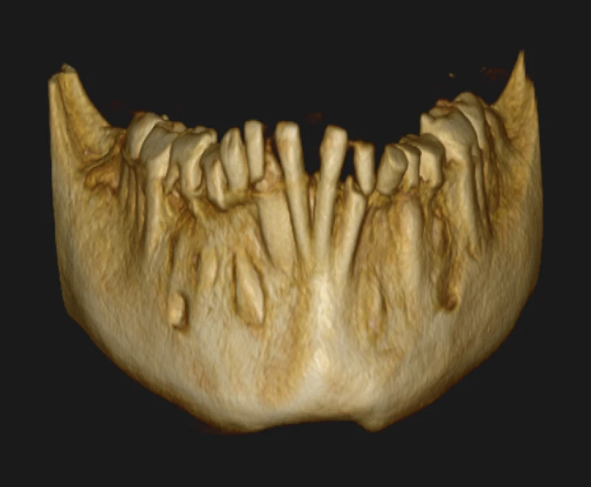 saraswati dental college