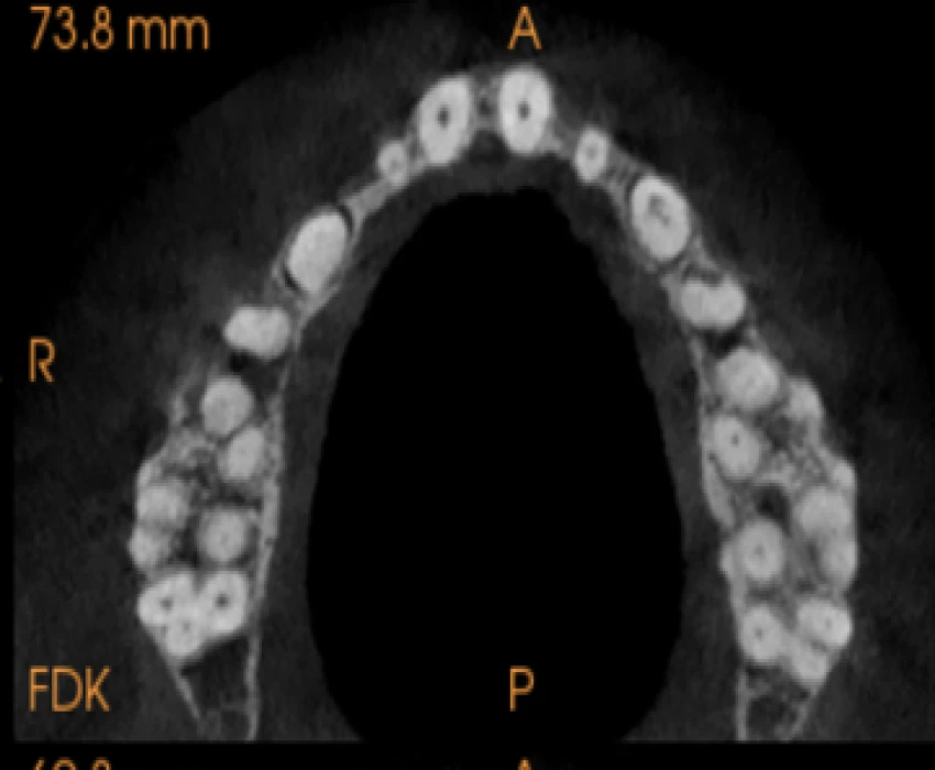 saraswati dental college