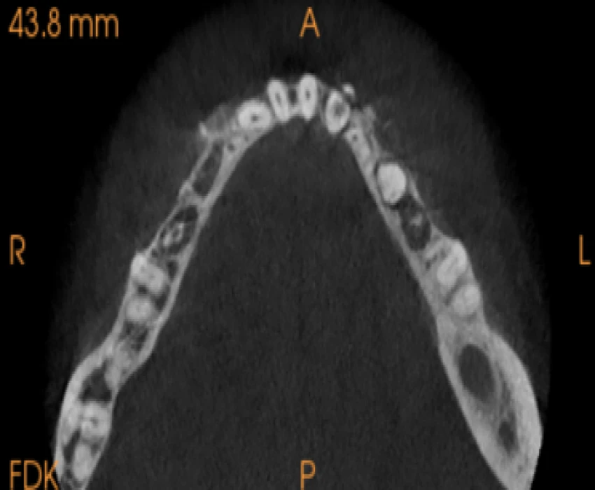 saraswati dental college