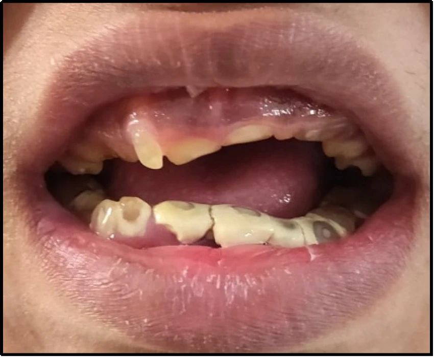 saraswati dental college