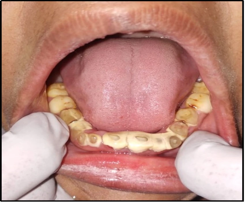 saraswati dental college