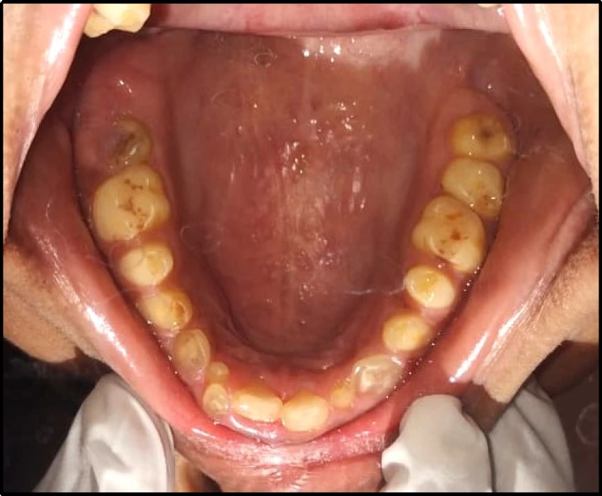 saraswati dental college