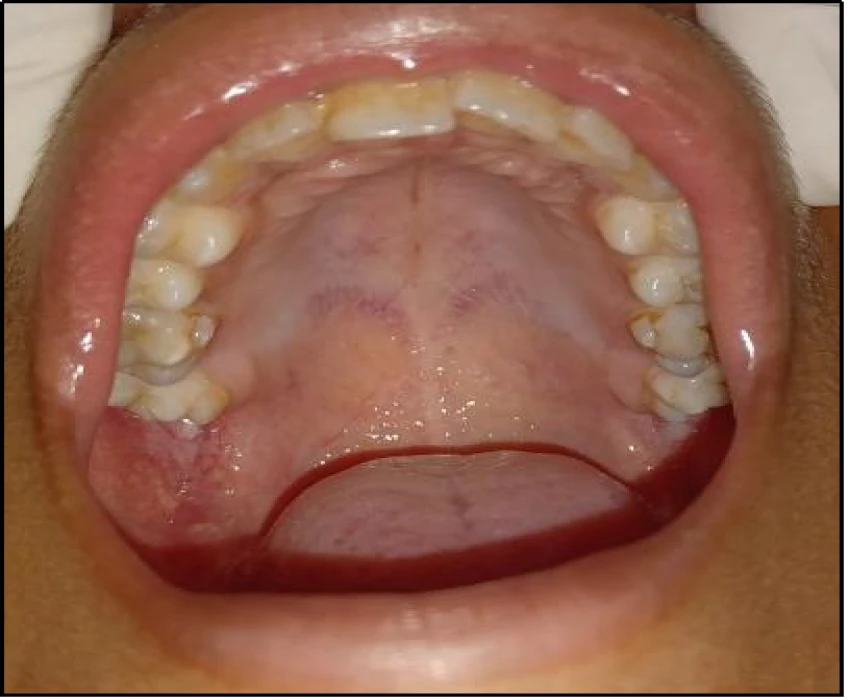 saraswati dental college