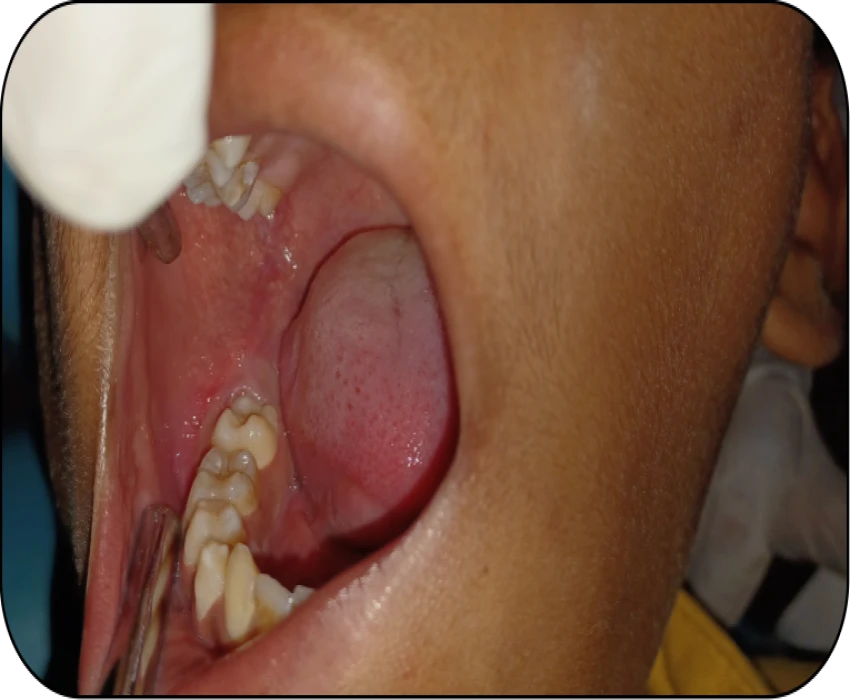 saraswati dental college