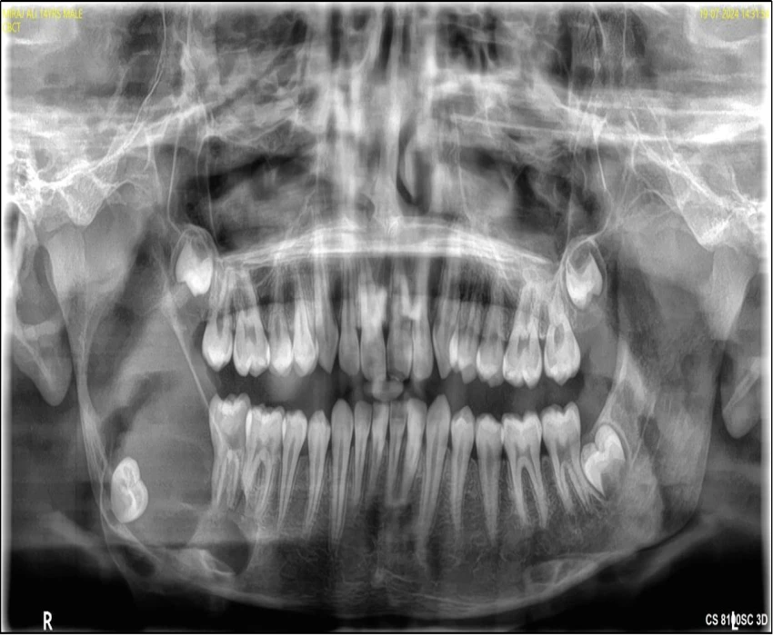 saraswati dental college