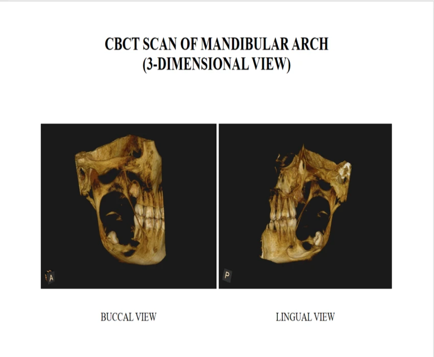 saraswati dental college