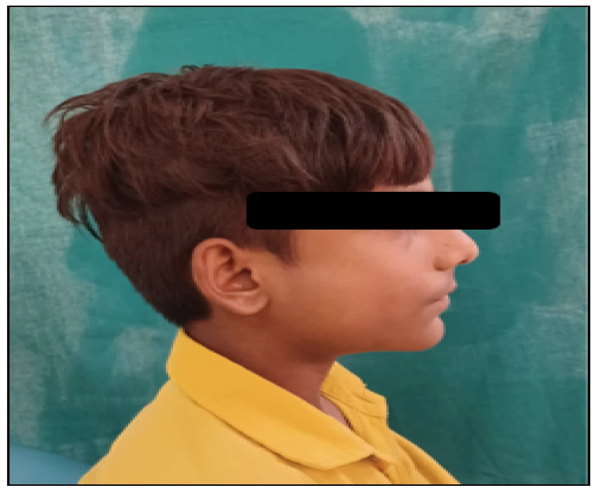 saraswati dental college