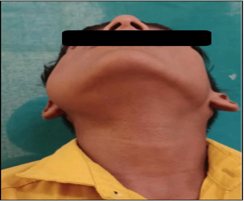 saraswati dental college