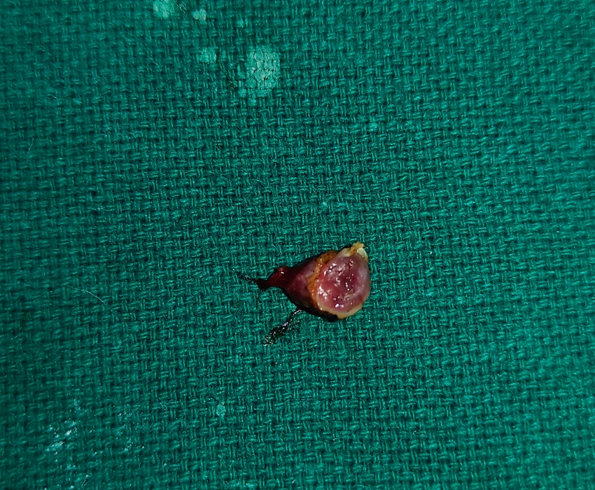 saraswati dental college