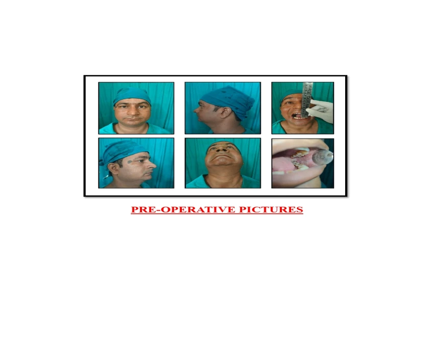 saraswati dental college