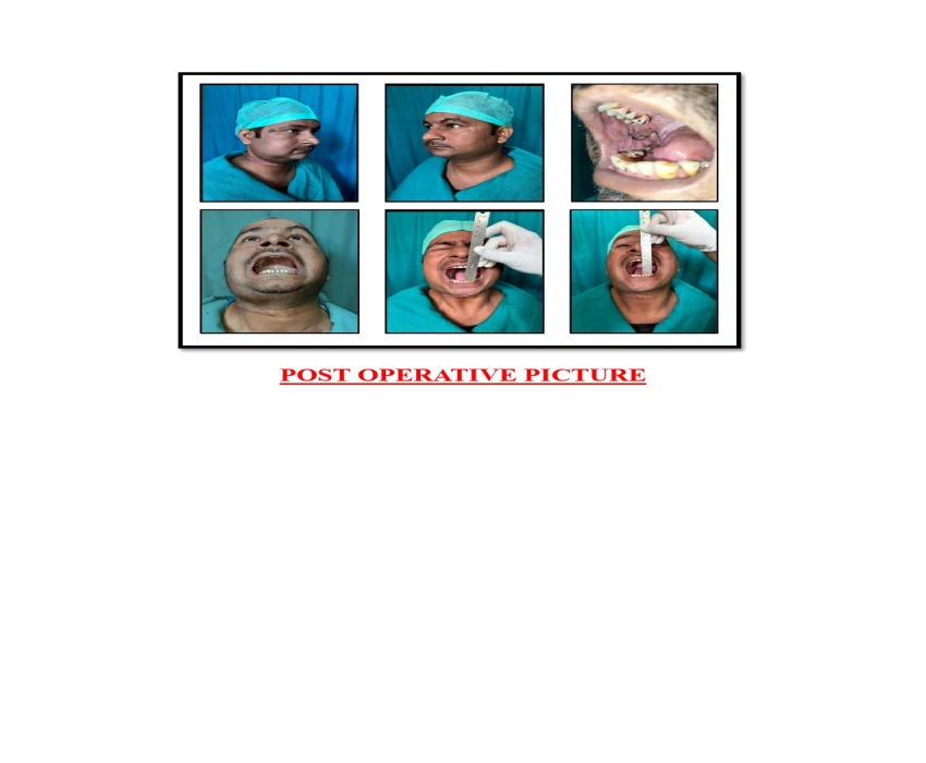 saraswati dental college