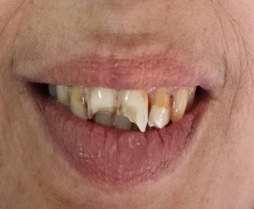 saraswati dental college