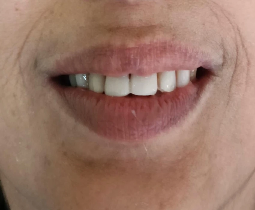 saraswati dental college