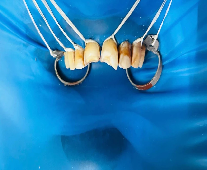 saraswati dental college