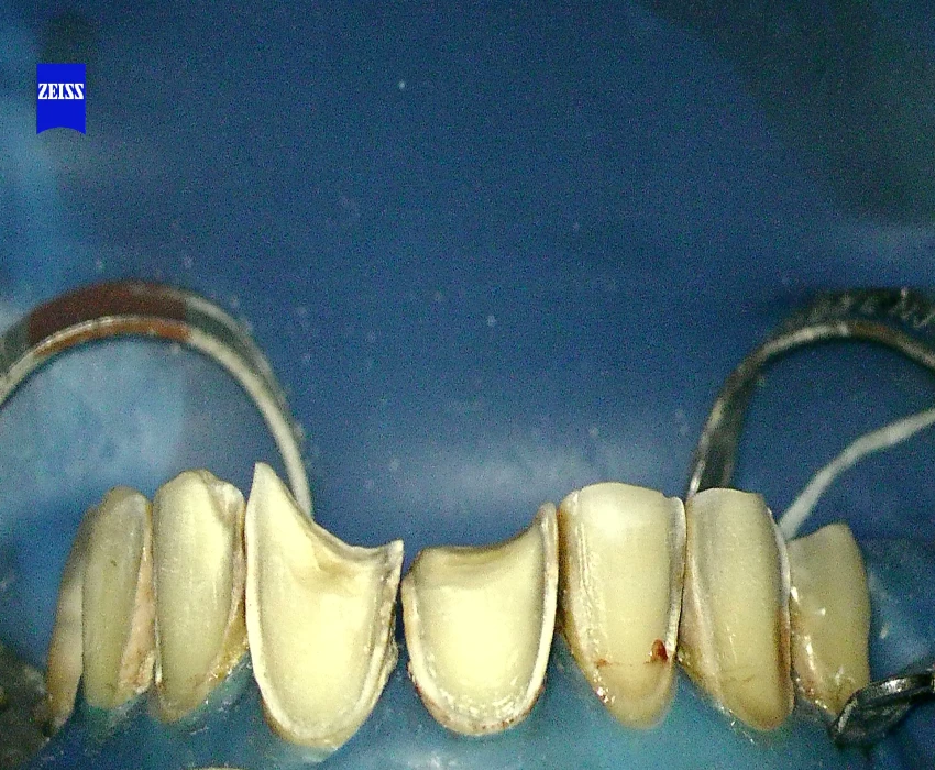 saraswati dental college